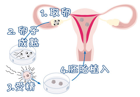 男性因素案例